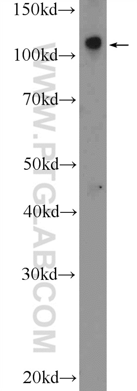 WB analysis of mouse lung using 26064-1-AP