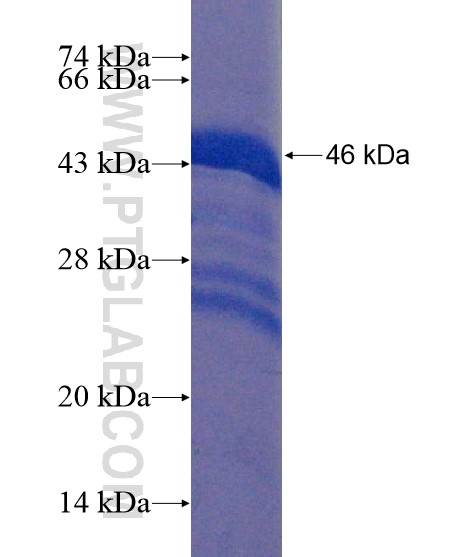 RAX fusion protein Ag19364 SDS-PAGE