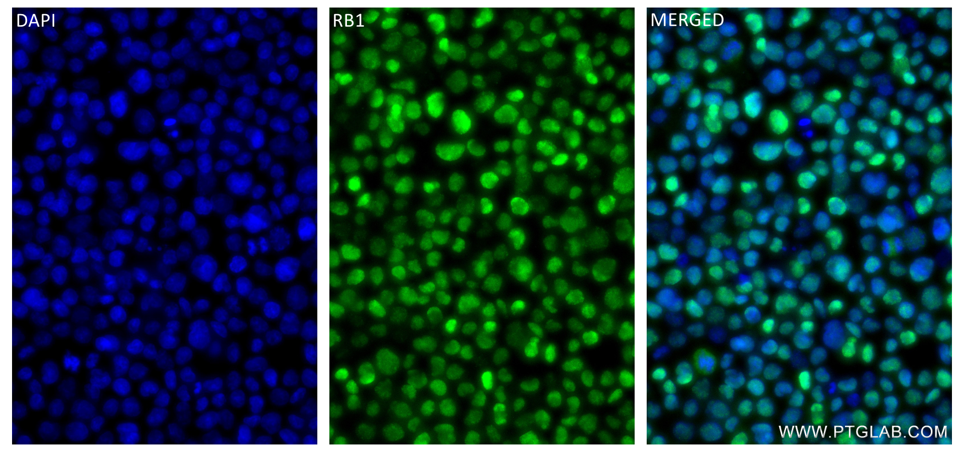 Phospho-RB1 (Ser780)