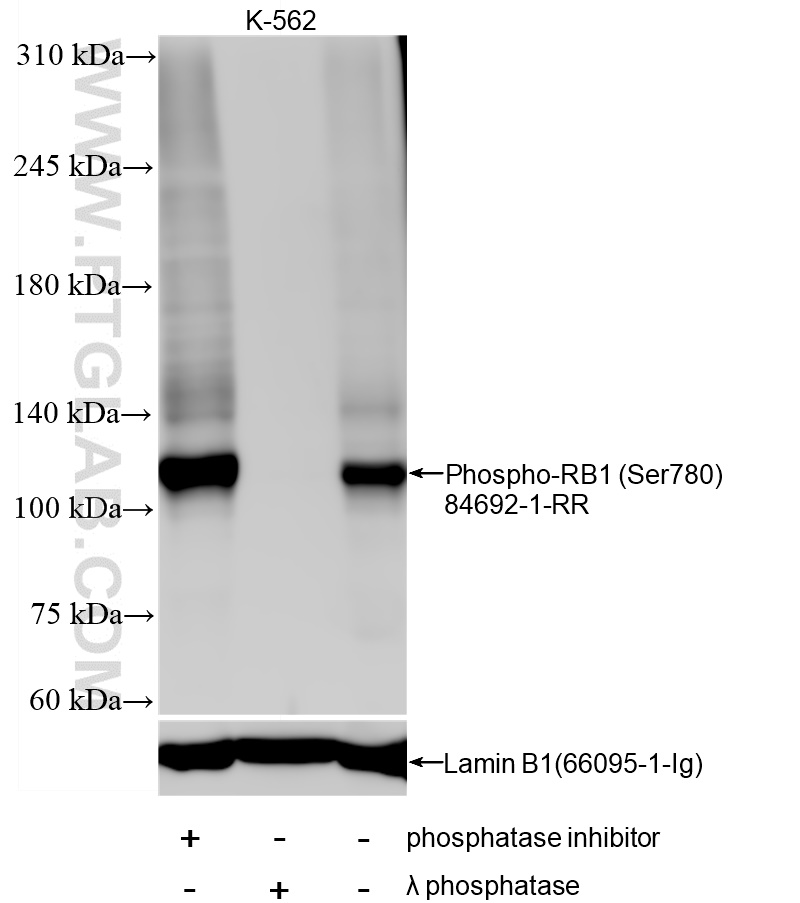 WB analysis using 84692-1-RR (same clone as 84692-1-PBS)