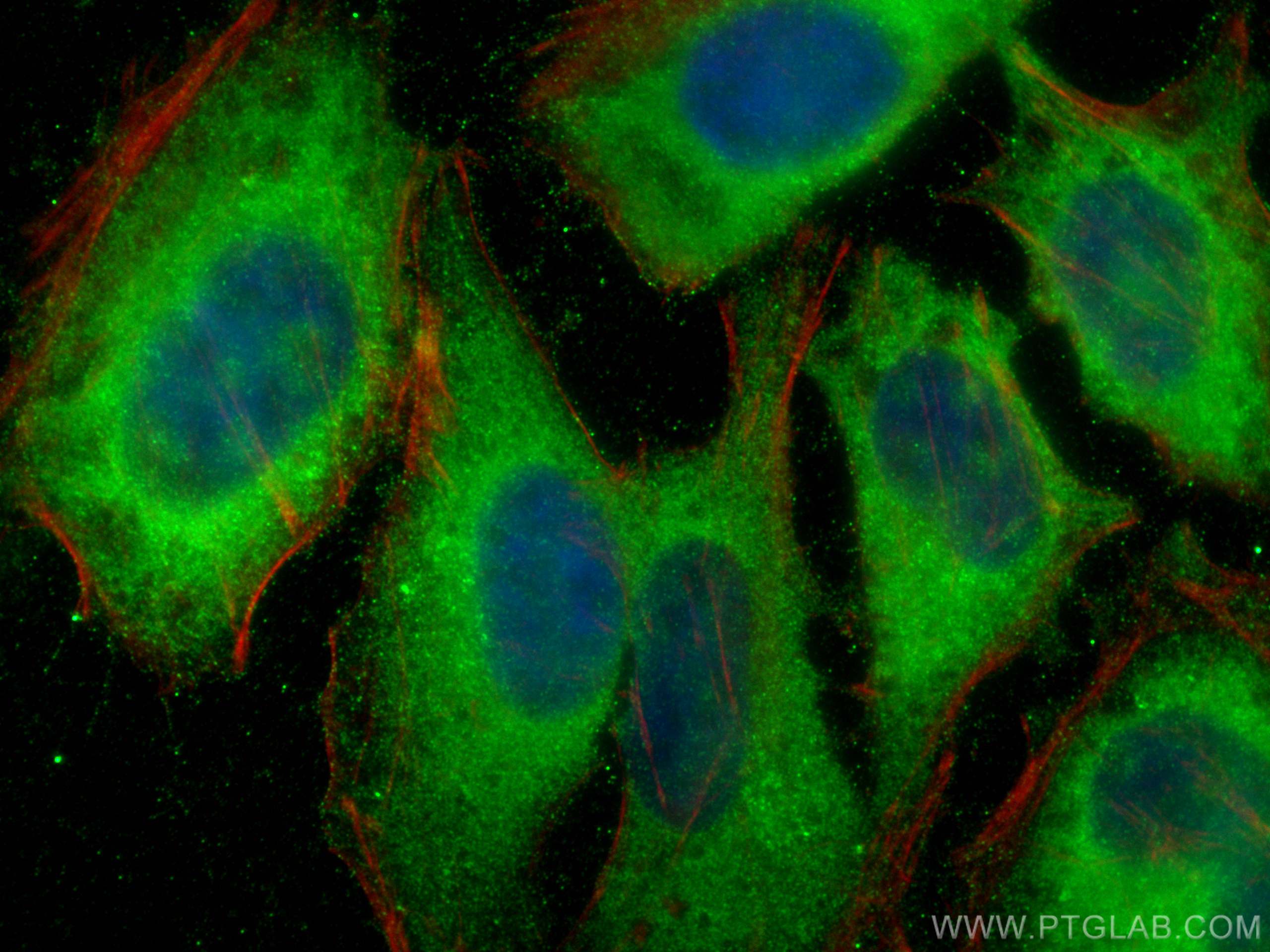 IF Staining of HeLa using 10069-1-AP