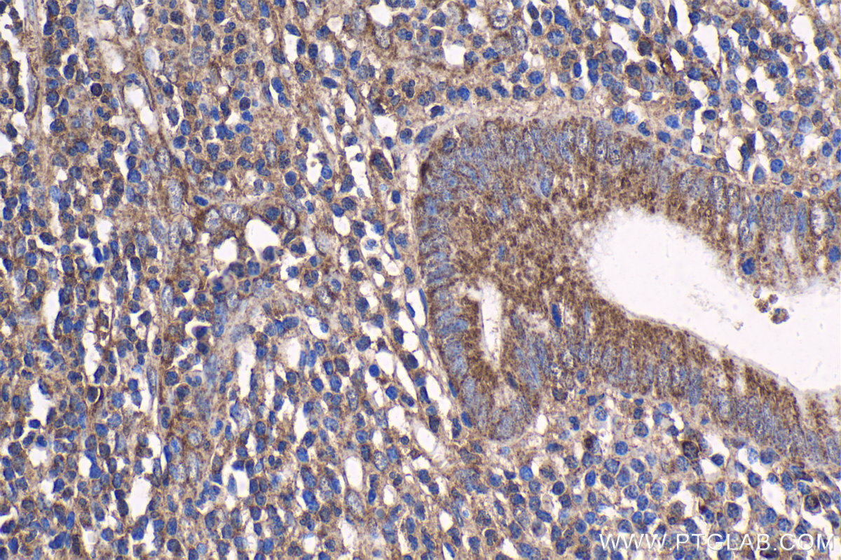 IHC staining of human appendicitis using 10069-1-AP