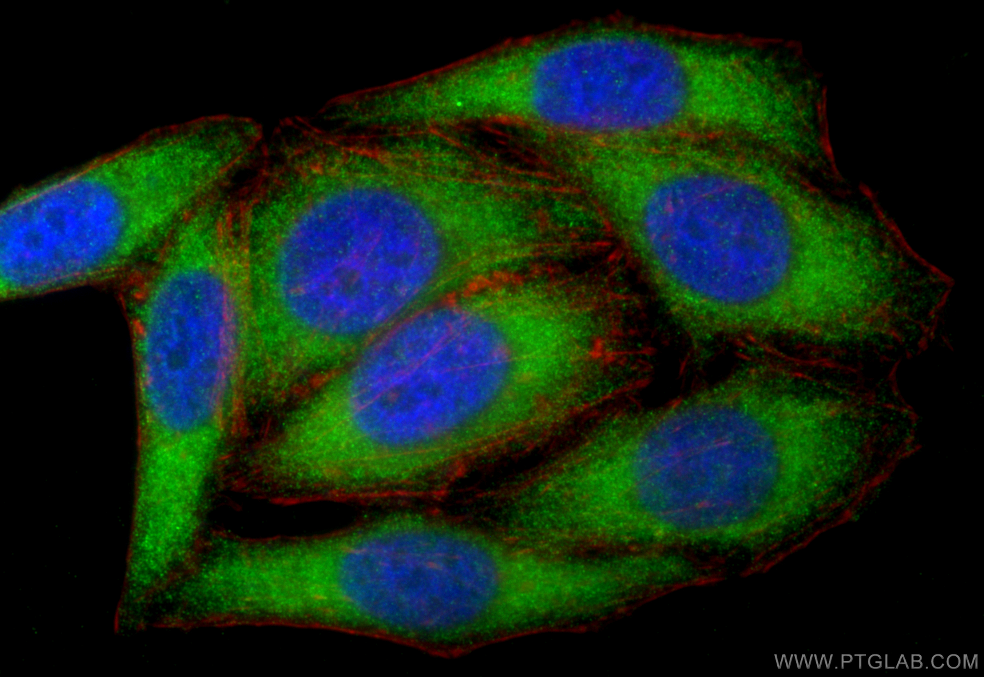 IF Staining of HepG2 using 17250-1-AP