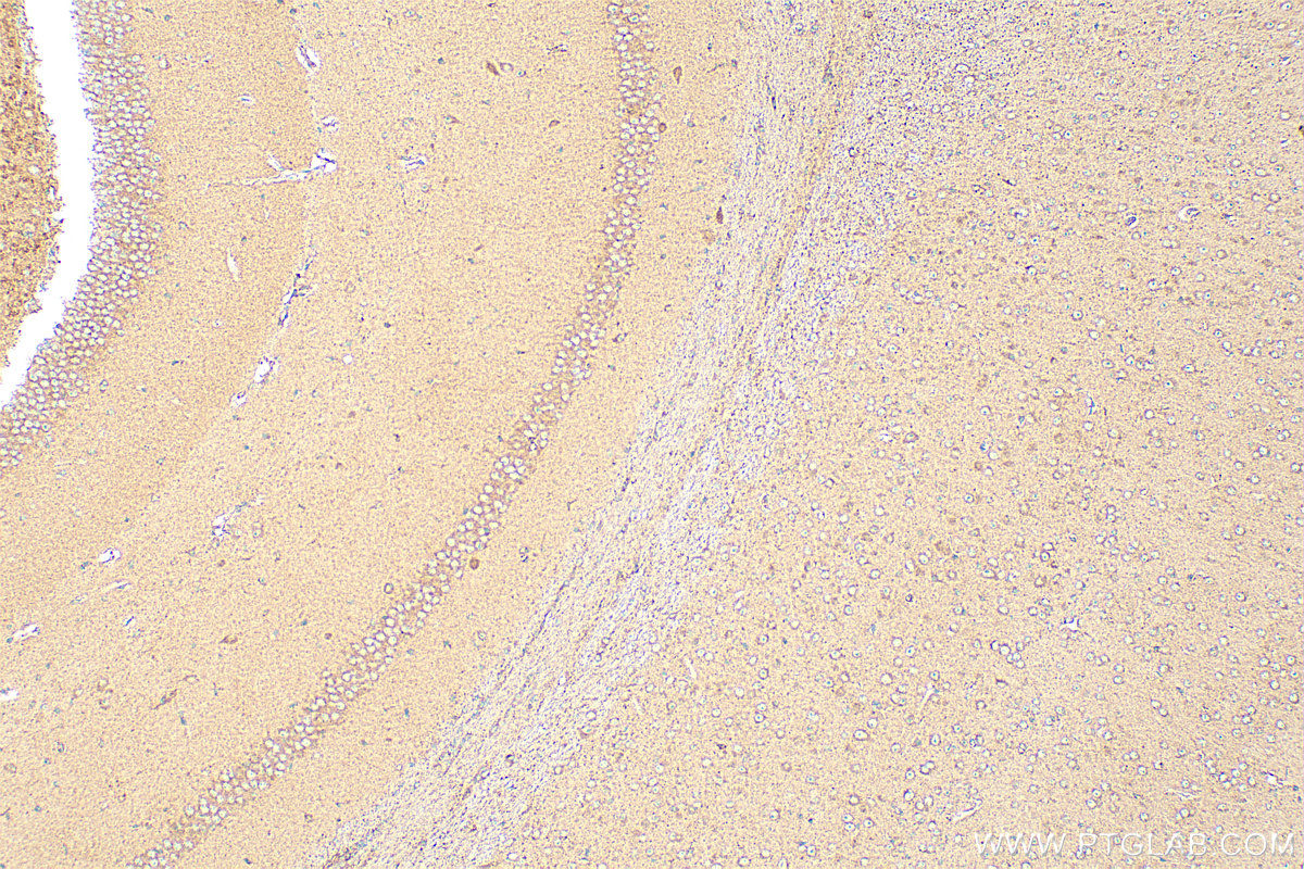 IHC staining of mouse brain using 17250-1-AP