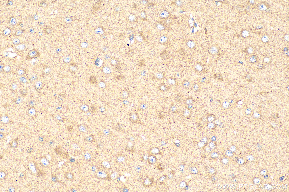 IHC staining of mouse brain using 17250-1-AP