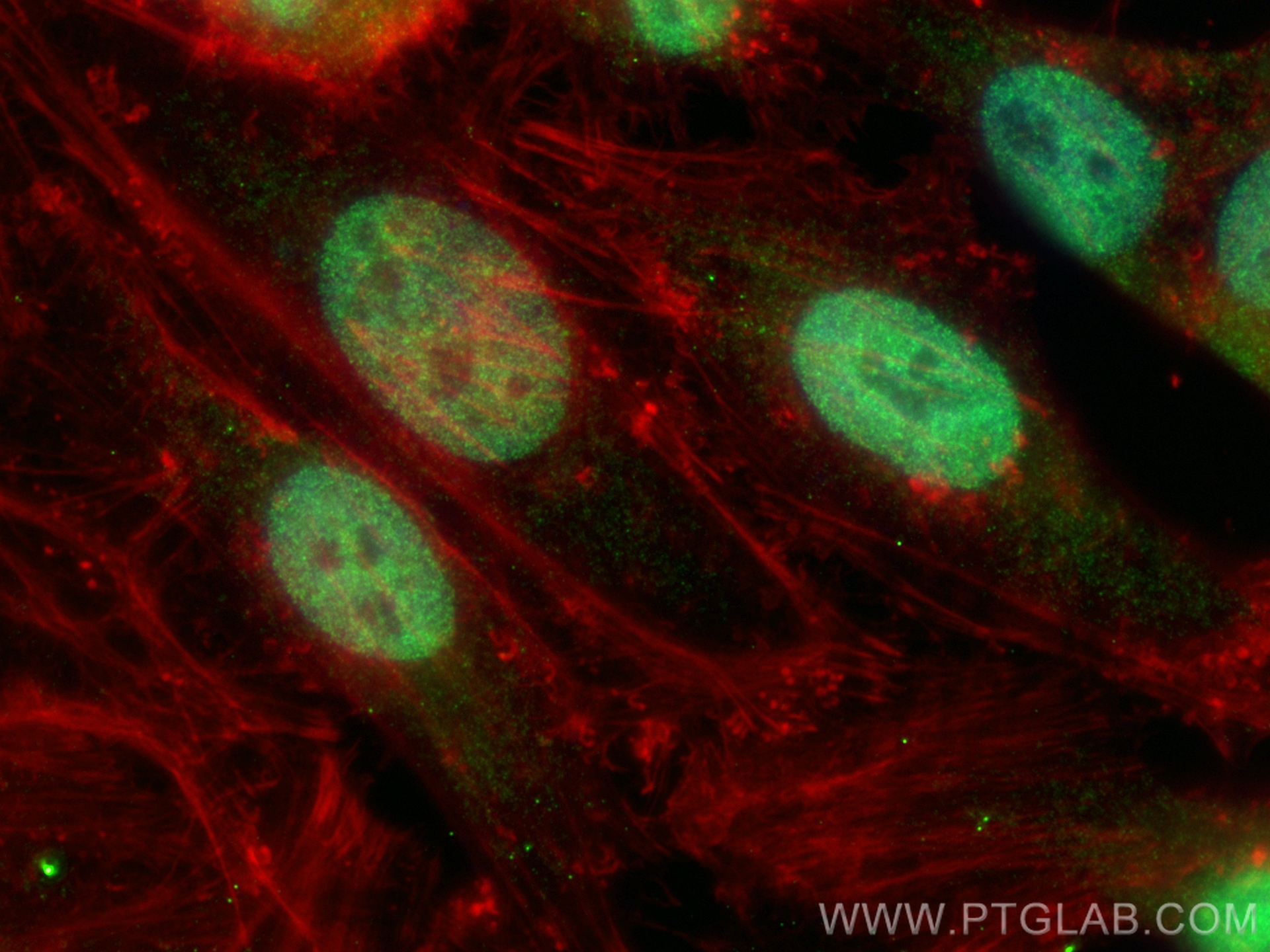 IF Staining of HeLa using 14557-1-AP (same clone as 14557-1-PBS)