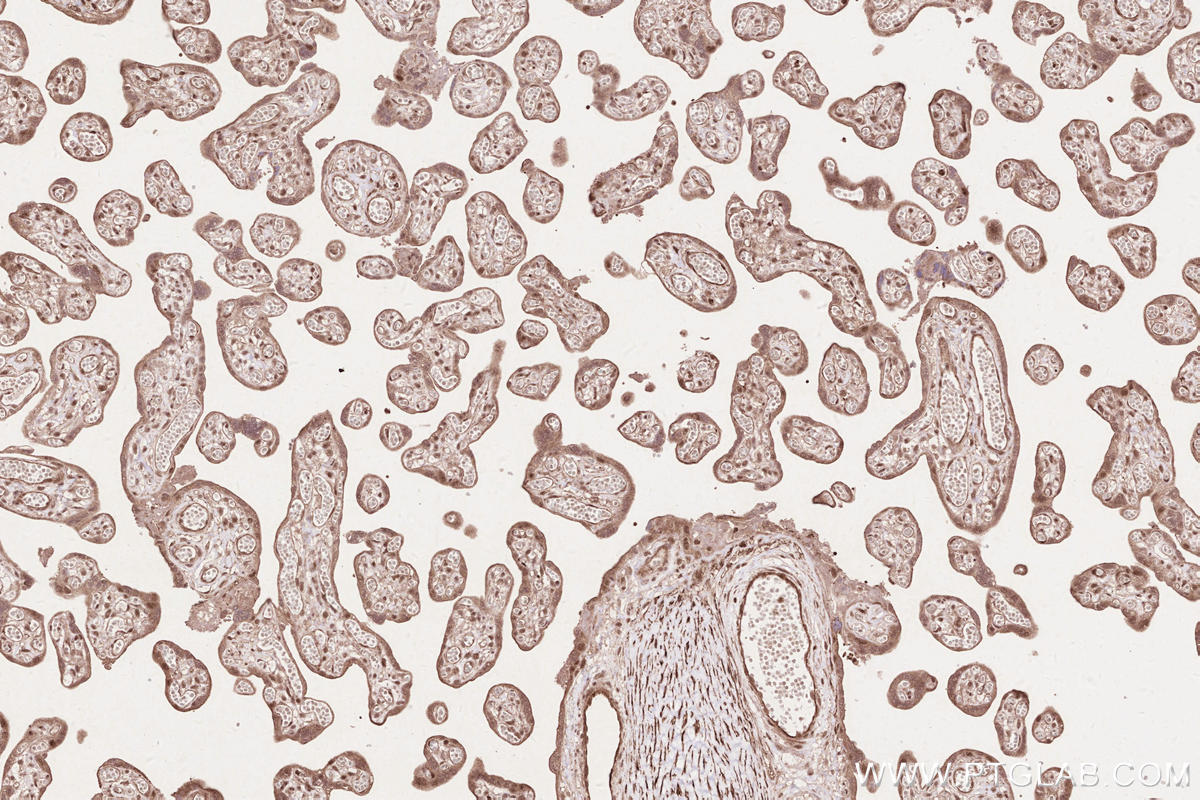 IHC staining of human placenta using 11882-1-AP