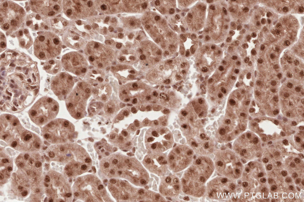 IHC staining of mouse kidney using 11882-1-AP