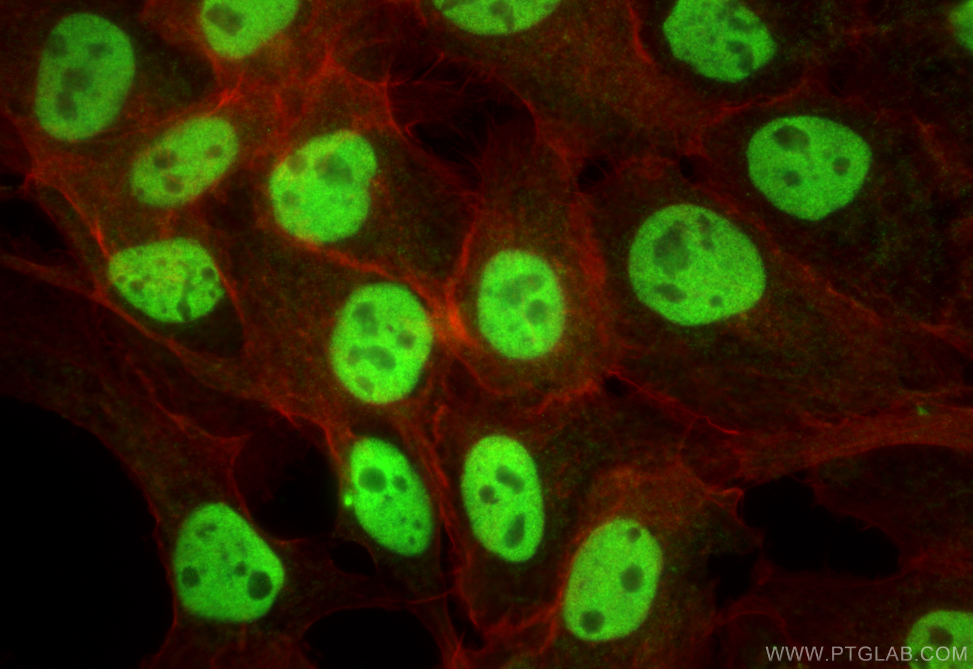 IF Staining of A431 using 20365-1-AP