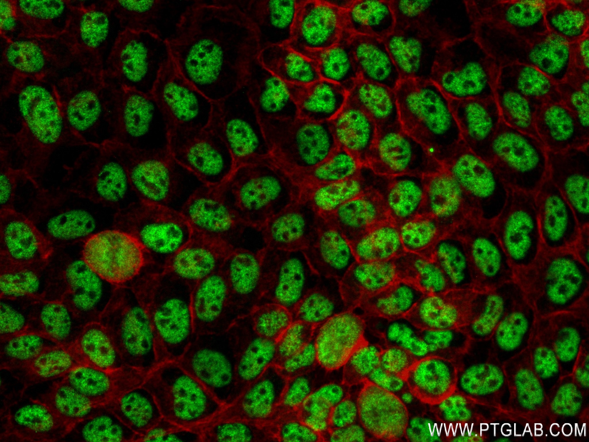 IF Staining of A431 using 84104-2-RR