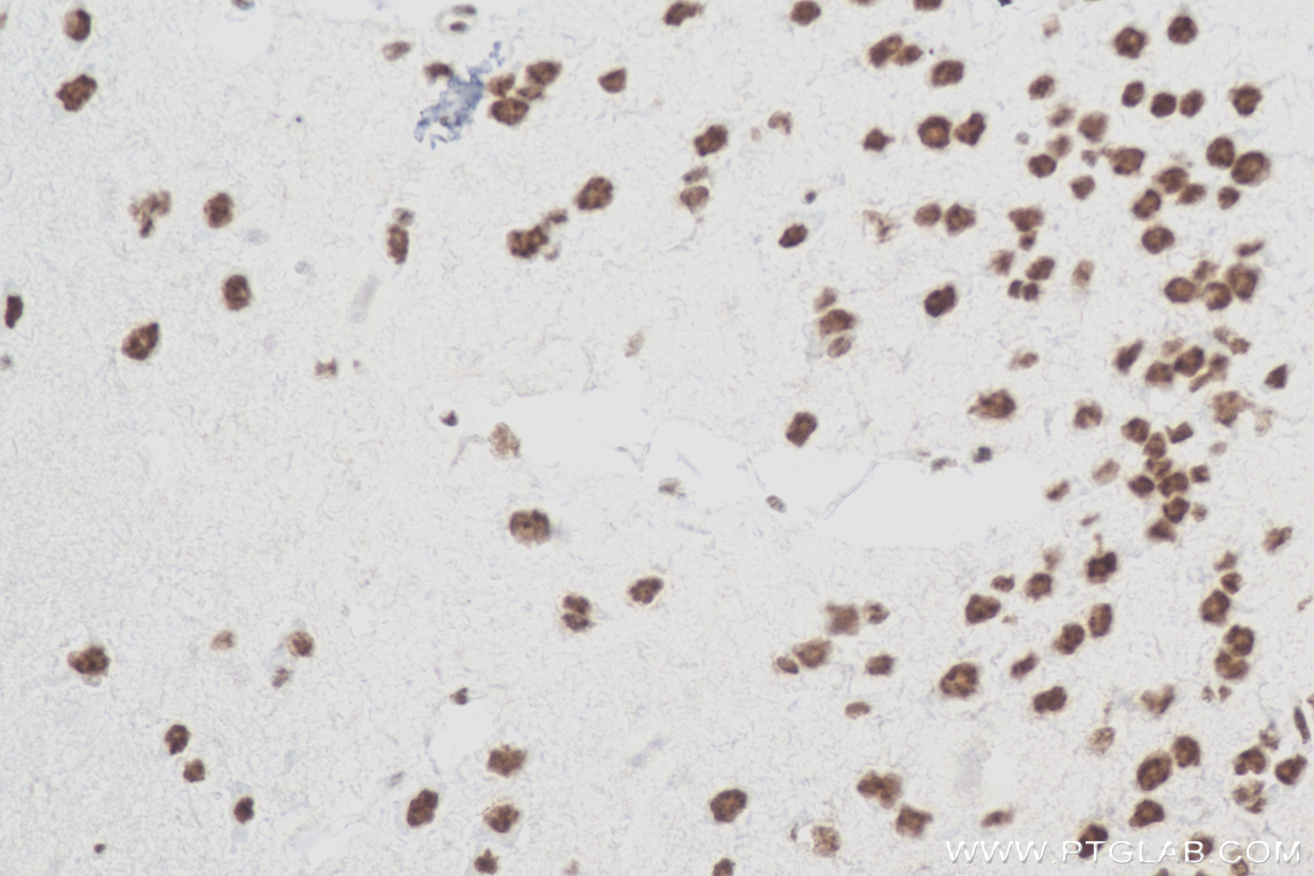 IHC staining of mouse brain using 84104-2-RR