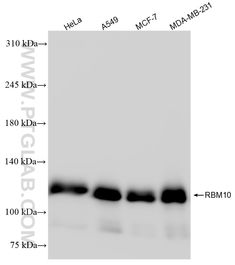 WB analysis using 84104-2-RR