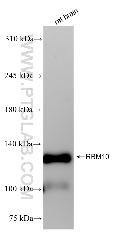 WB analysis of rat brain using 84104-2-RR