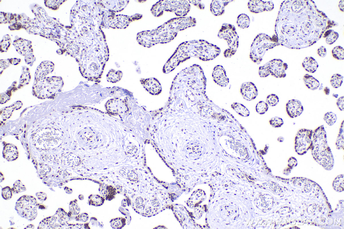 IHC staining of human placenta using 84104-4-RR (same clone as 84104-4-PBS)