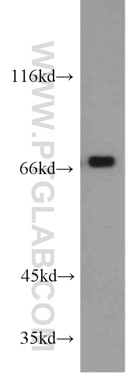 RBM14 Polyclonal antibody