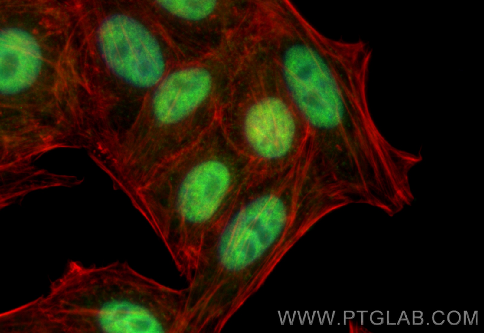 IF Staining of HepG2 using 10587-1-AP