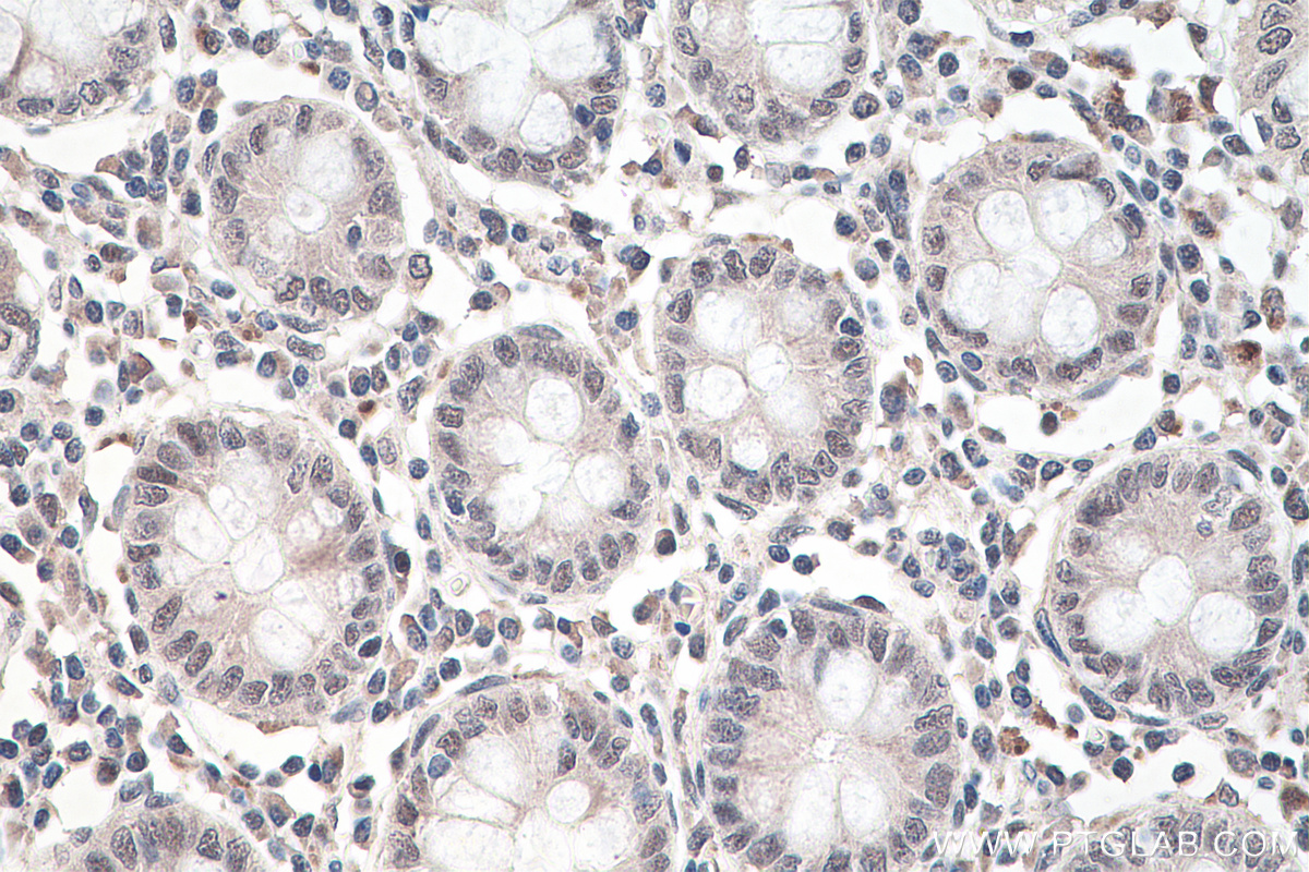 IHC staining of human colon using 67506-1-Ig (same clone as 67506-1-PBS)