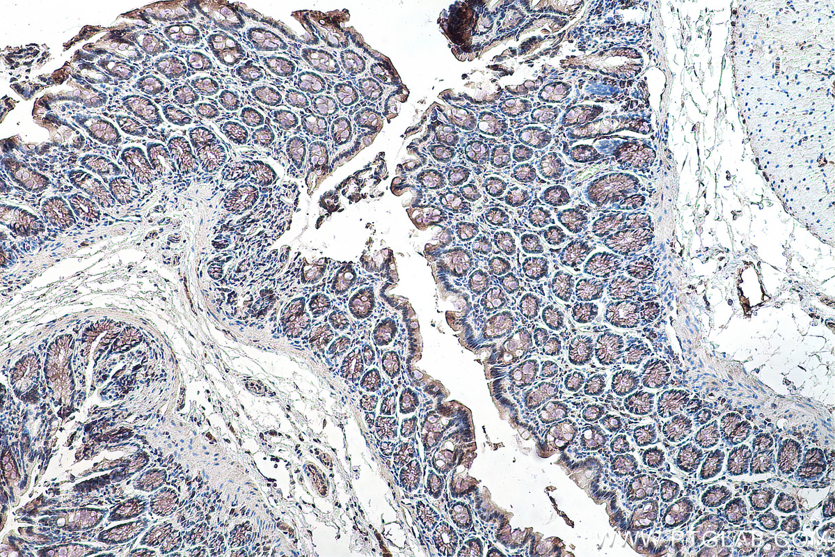 IHC staining of rat colon using 67506-1-Ig (same clone as 67506-1-PBS)