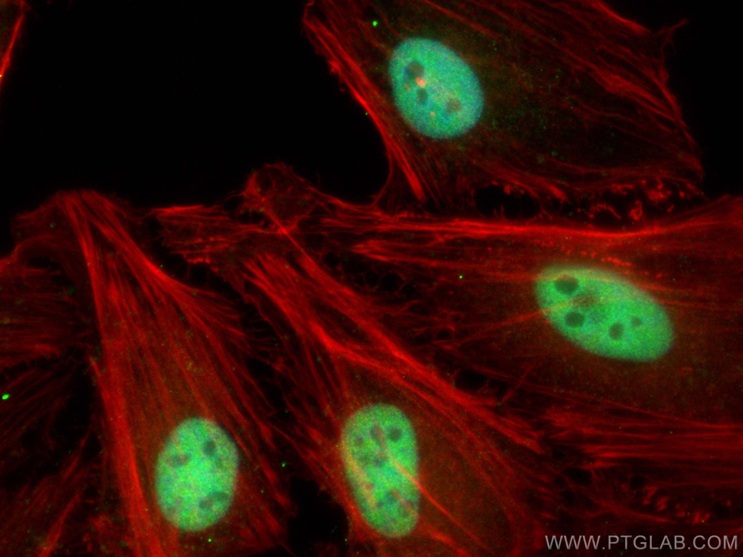 IF Staining of HeLa using 18893-1-AP