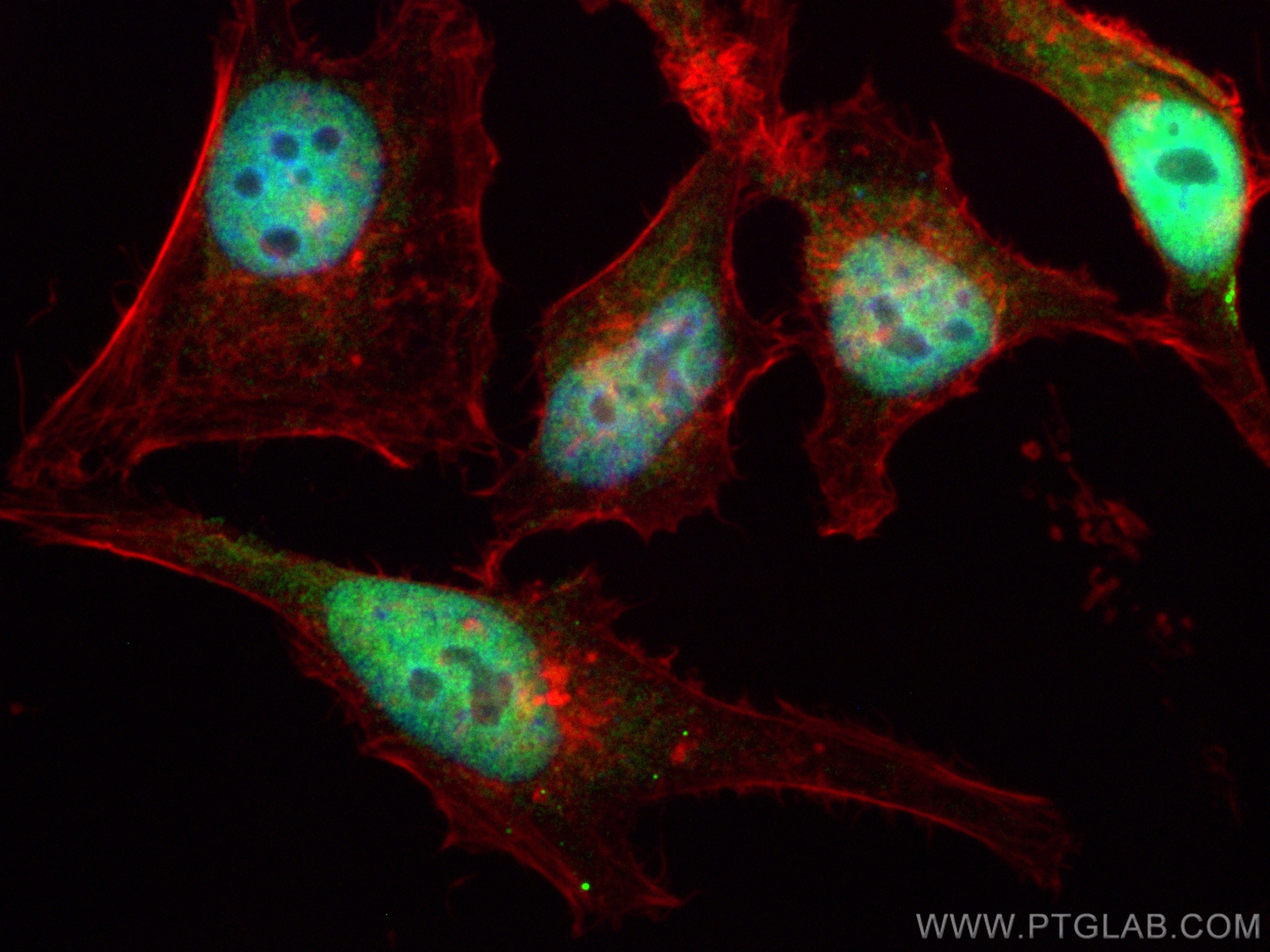 IF Staining of HeLa using CL488-18893