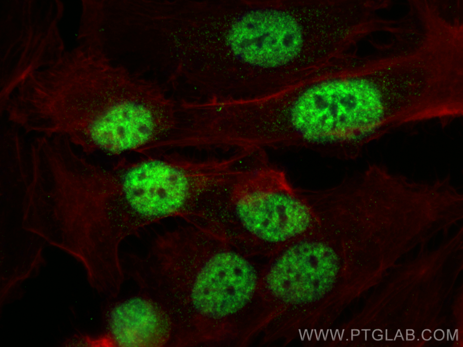 IF Staining of SKOV-3 using 13918-1-AP