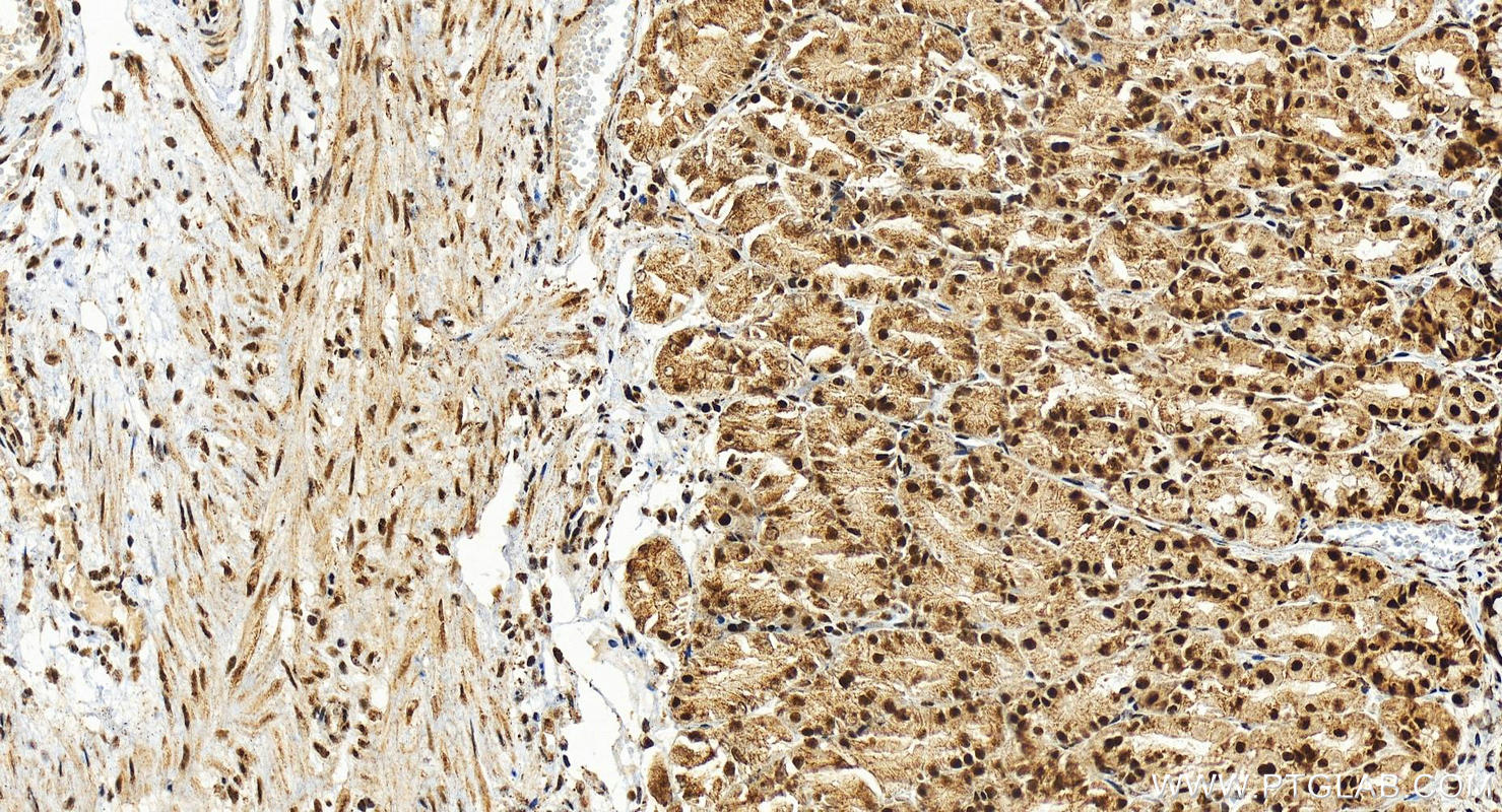 IHC staining of human stomach using 15374-1-AP