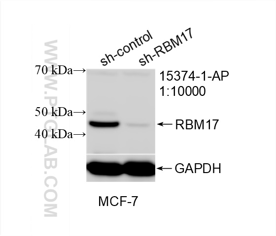 WB analysis of MCF-7 using 15374-1-AP