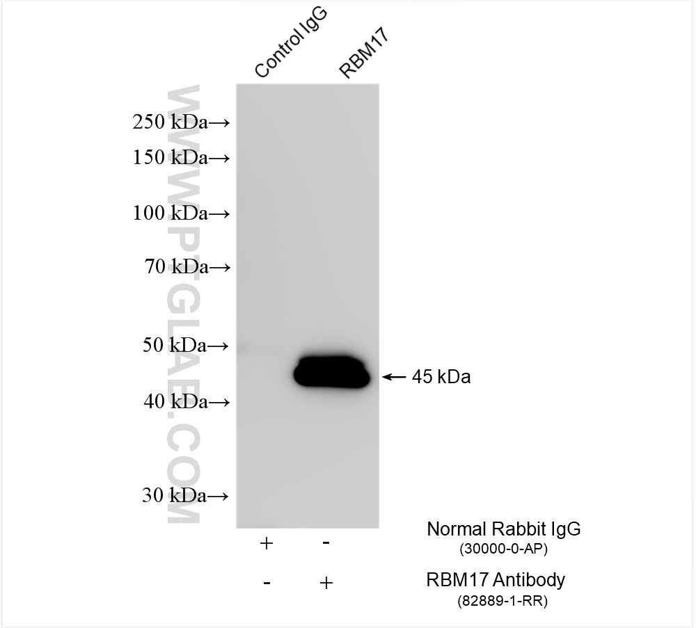 IP experiment of MCF-7 using 82889-1-RR