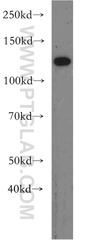 WB analysis of mouse colon using 19095-1-AP