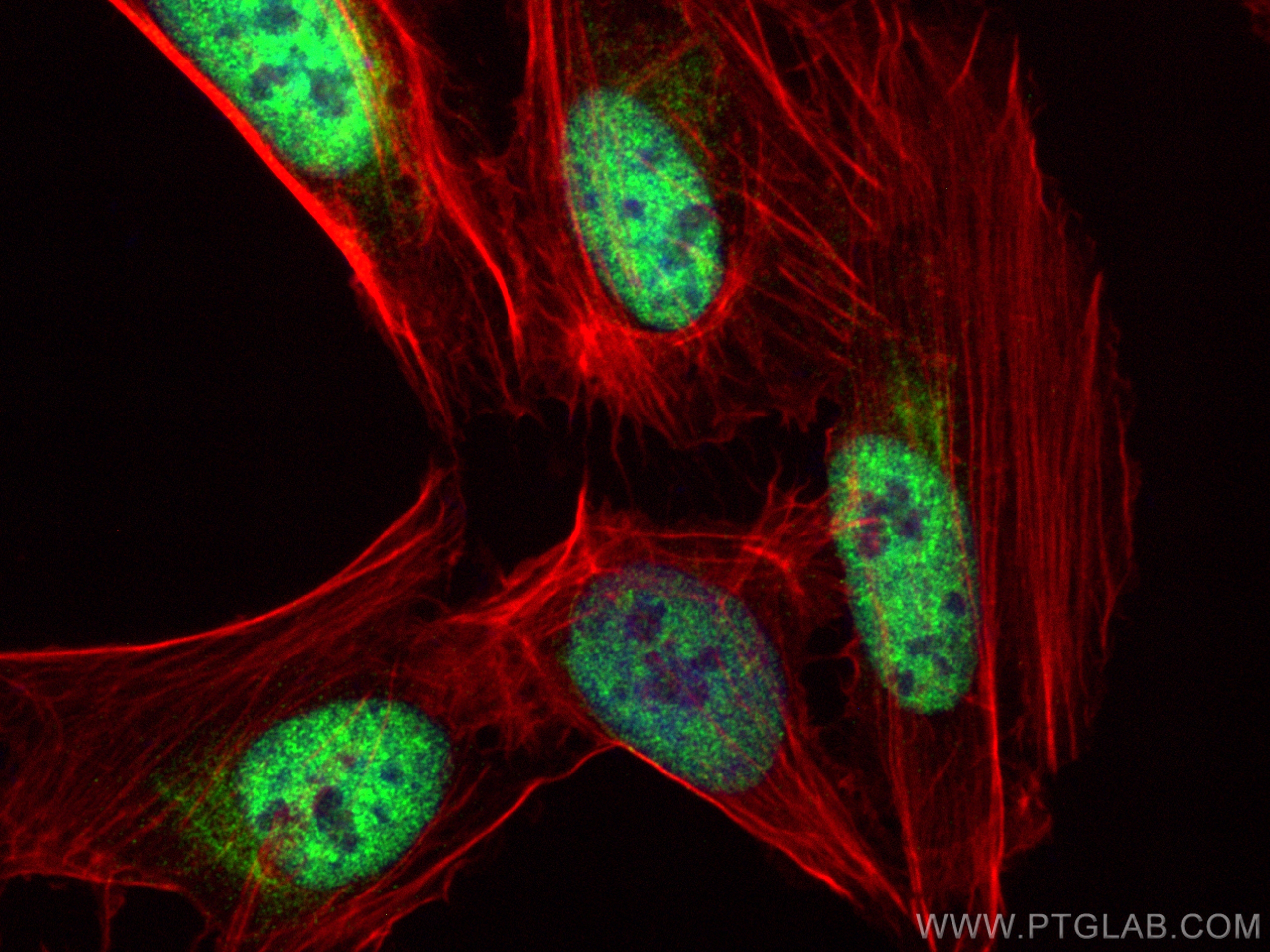 IF Staining of U2OS using 22103-1-AP