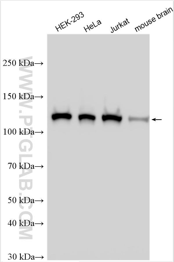 WB analysis using 25297-1-AP