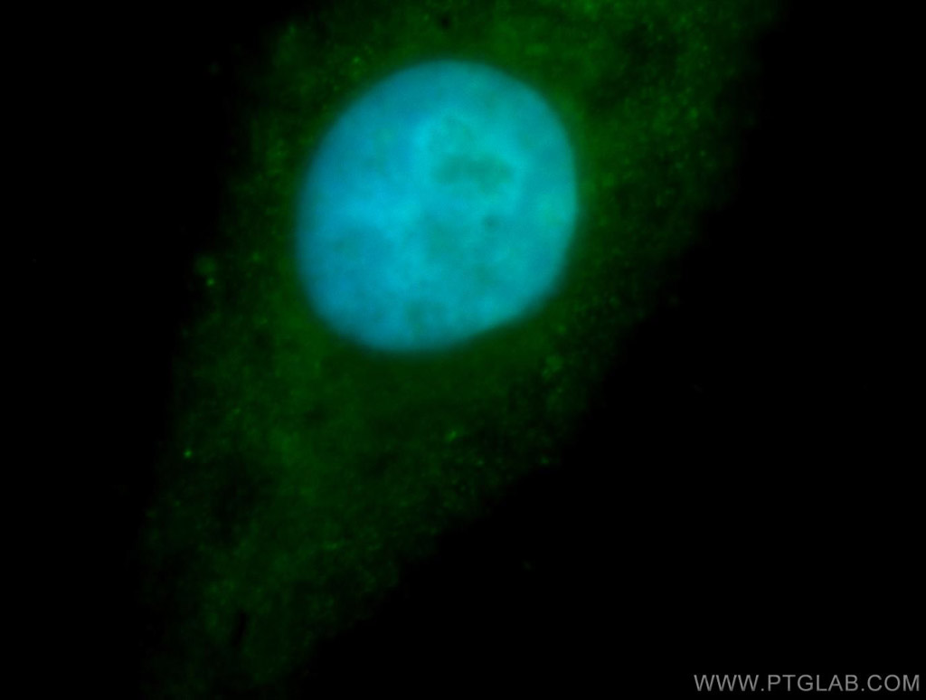 IF Staining of HepG2 using 16823-1-AP