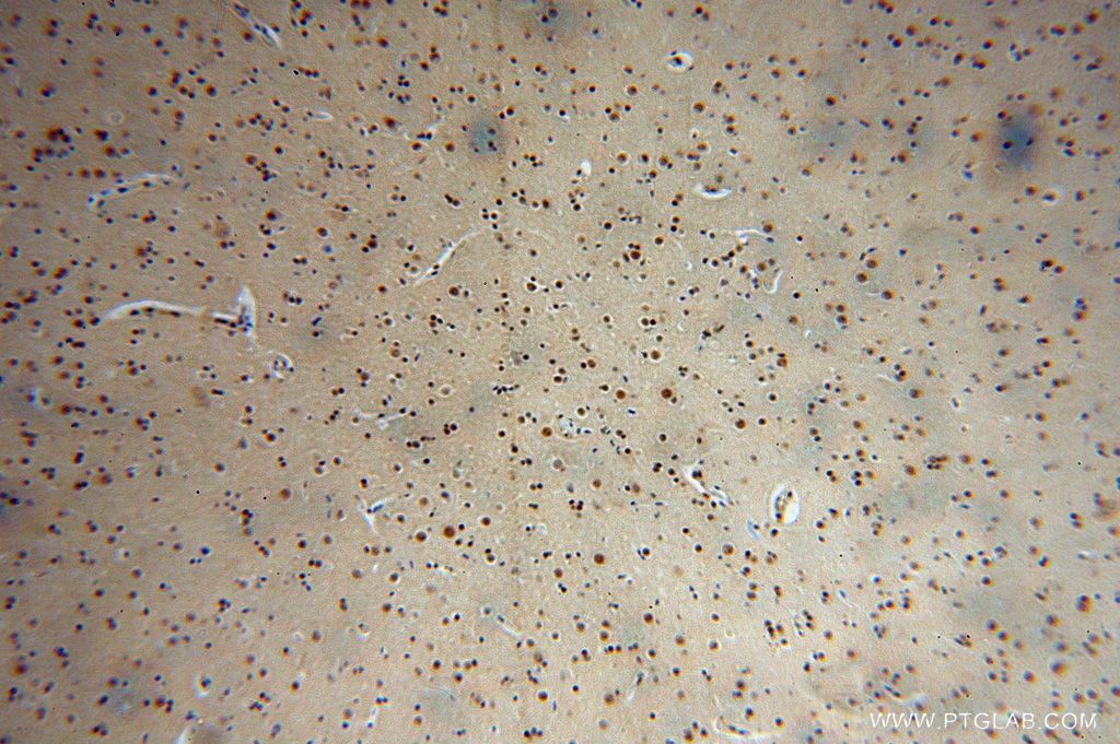 IHC staining of human brain using 16823-1-AP