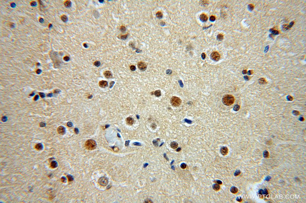 IHC staining of human brain using 16823-1-AP