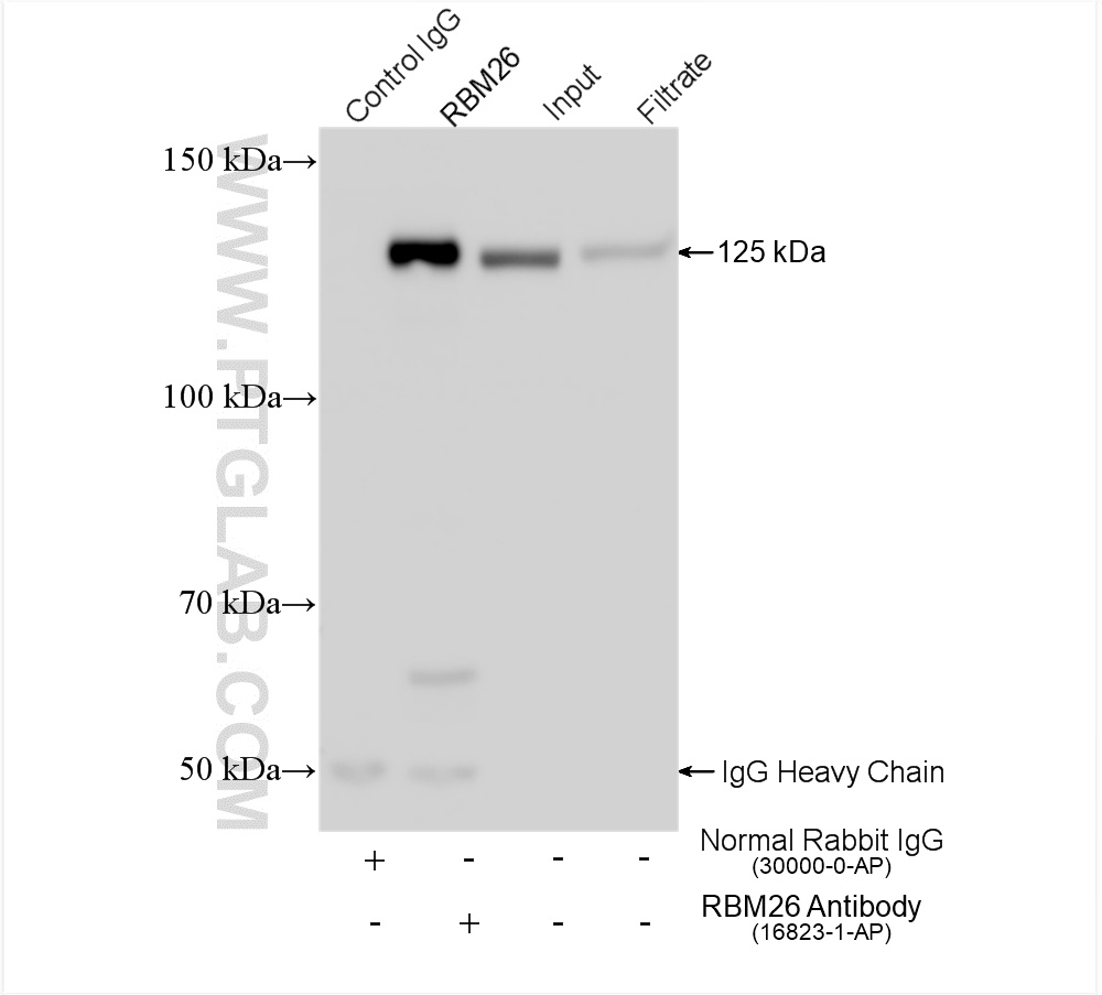 IP experiment of HEK-293 using 16823-1-AP