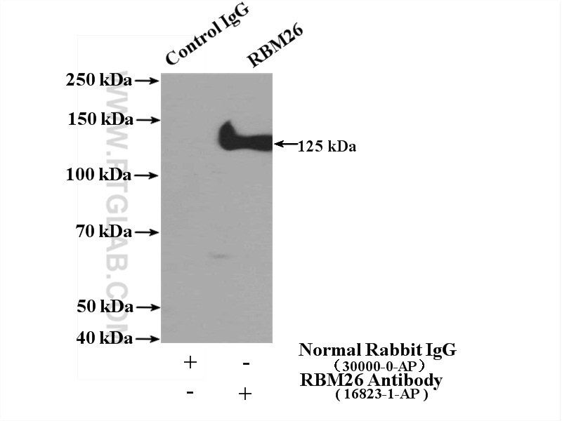 RBM26