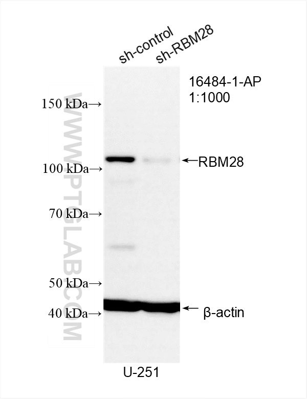 WB analysis of U-251 using 16484-1-AP