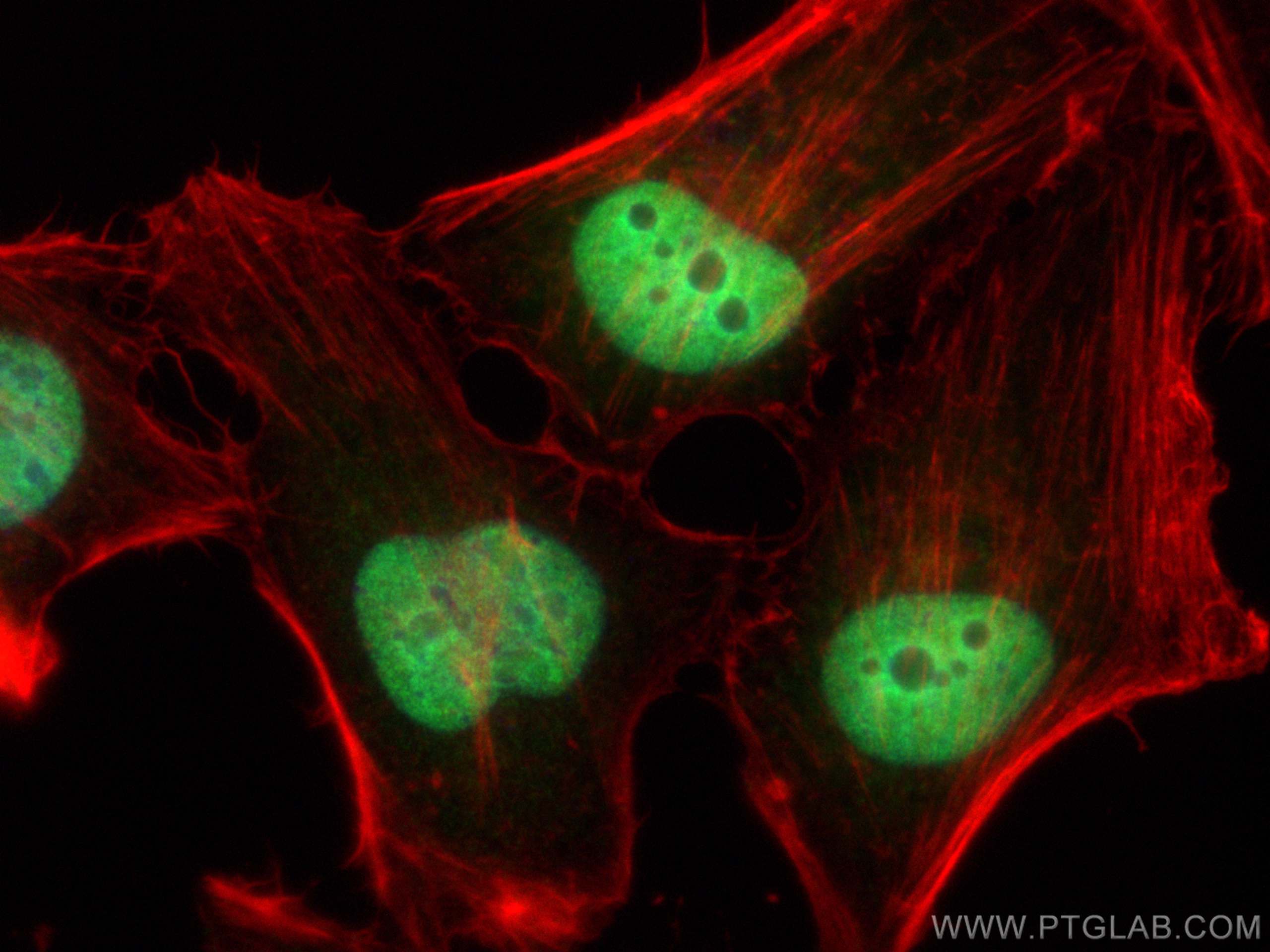 IF Staining of HeLa using 14363-1-AP