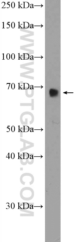 WB analysis of HEK-293T using 21339-1-AP