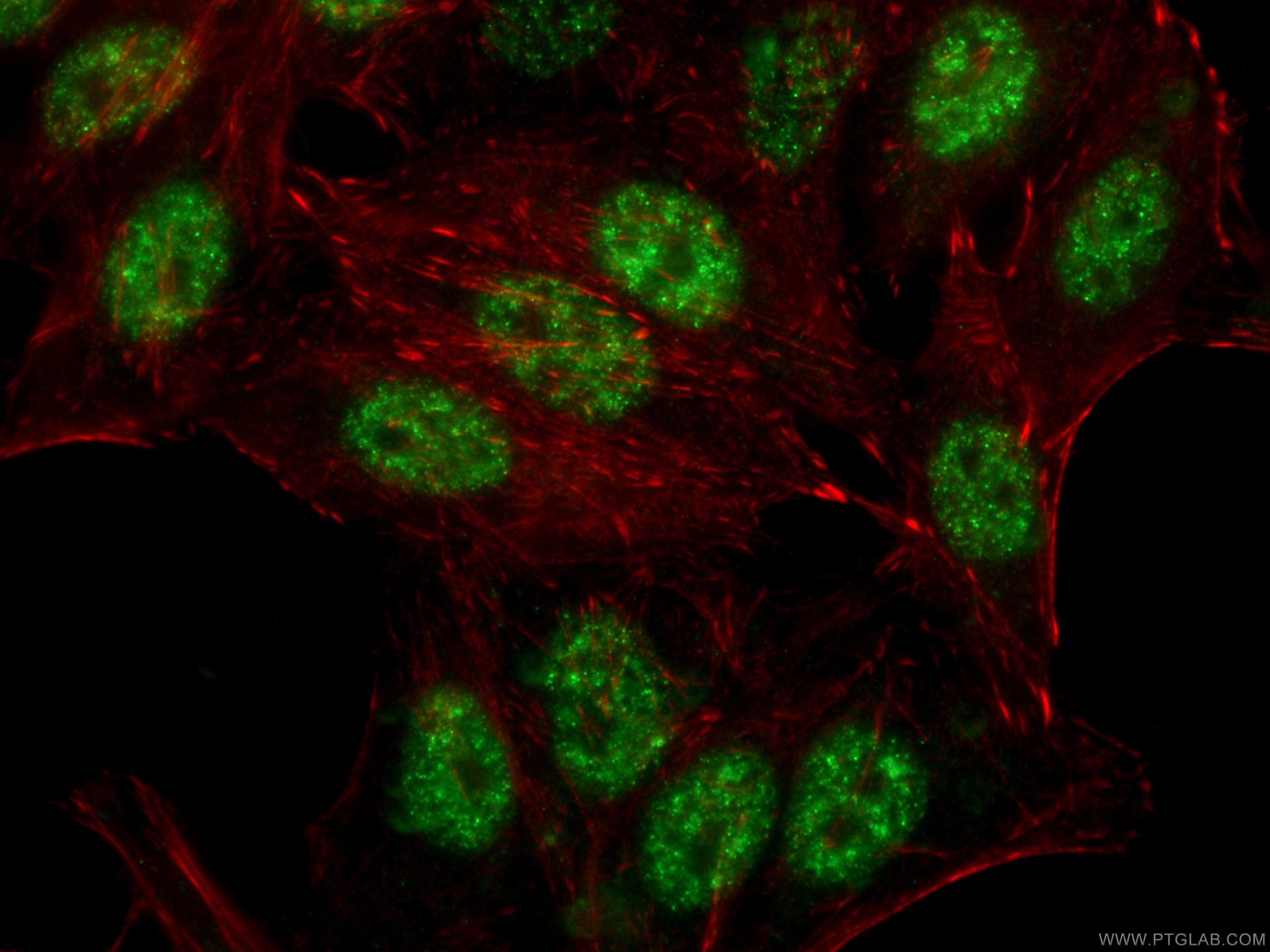 IF Staining of HepG2 using 67420-1-Ig (same clone as 67420-1-PBS)