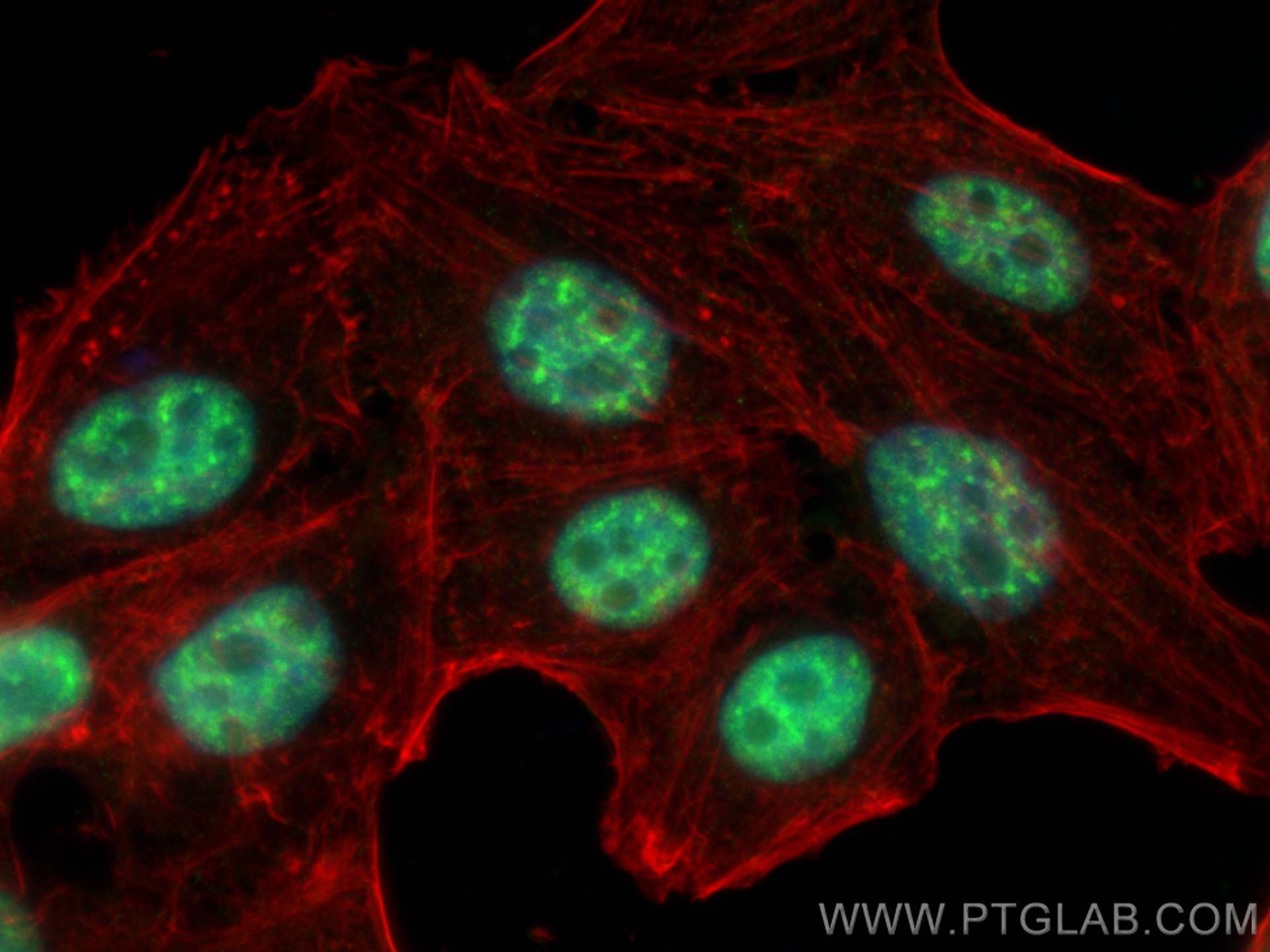 IF Staining of HepG2 using 67420-1-Ig (same clone as 67420-1-PBS)