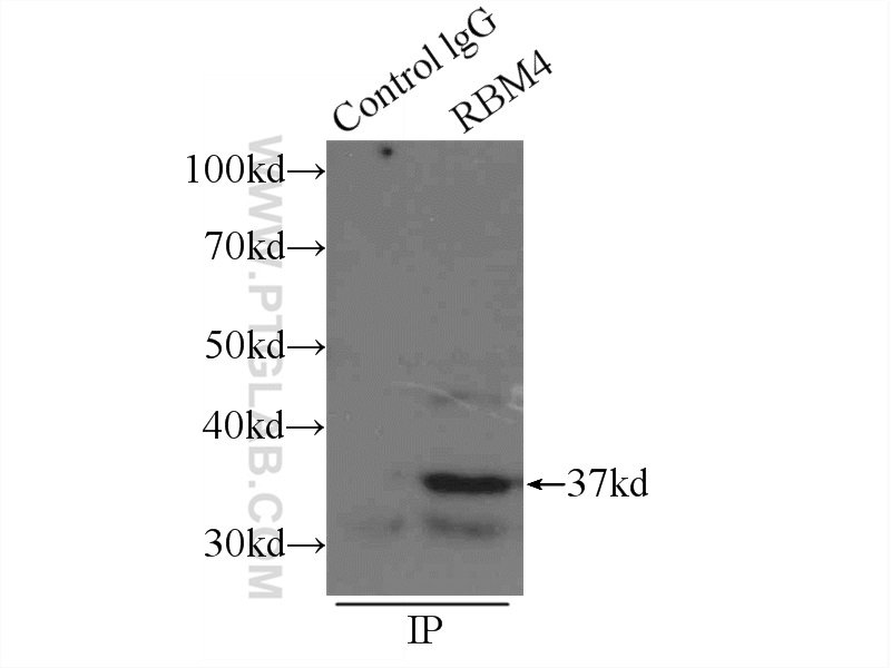 IP experiment of mouse heart using 11614-1-AP