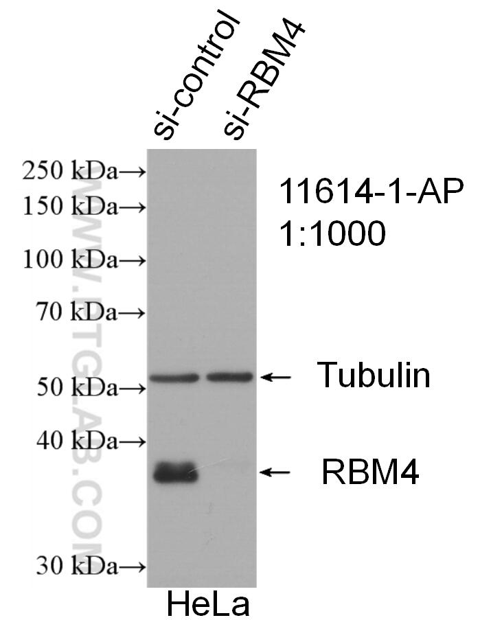 WB analysis of HeLa using 11614-1-AP