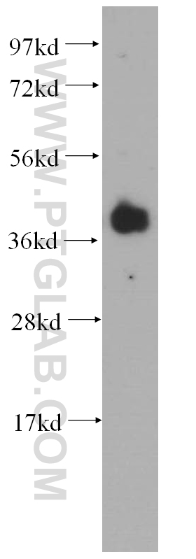 WB analysis of mouse brain using 11614-1-AP