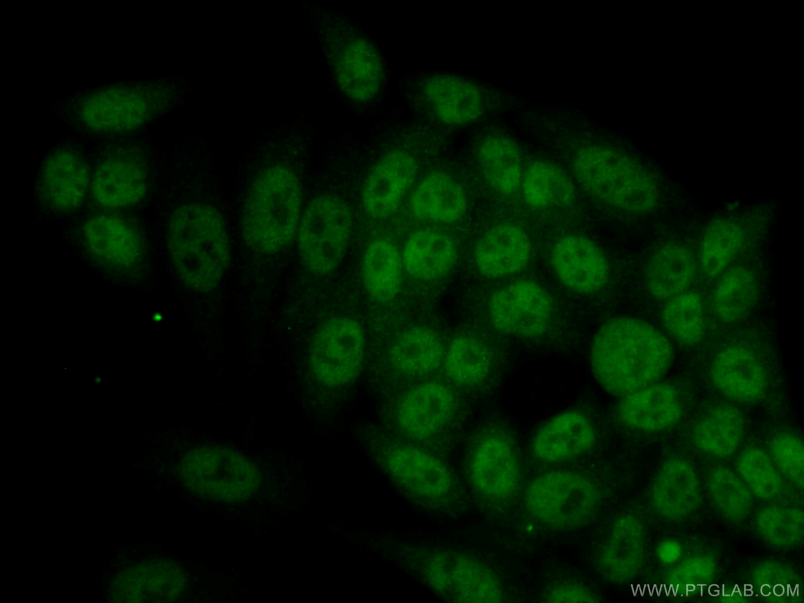 IF Staining of HeLa using 60292-1-Ig (same clone as 60292-1-PBS)