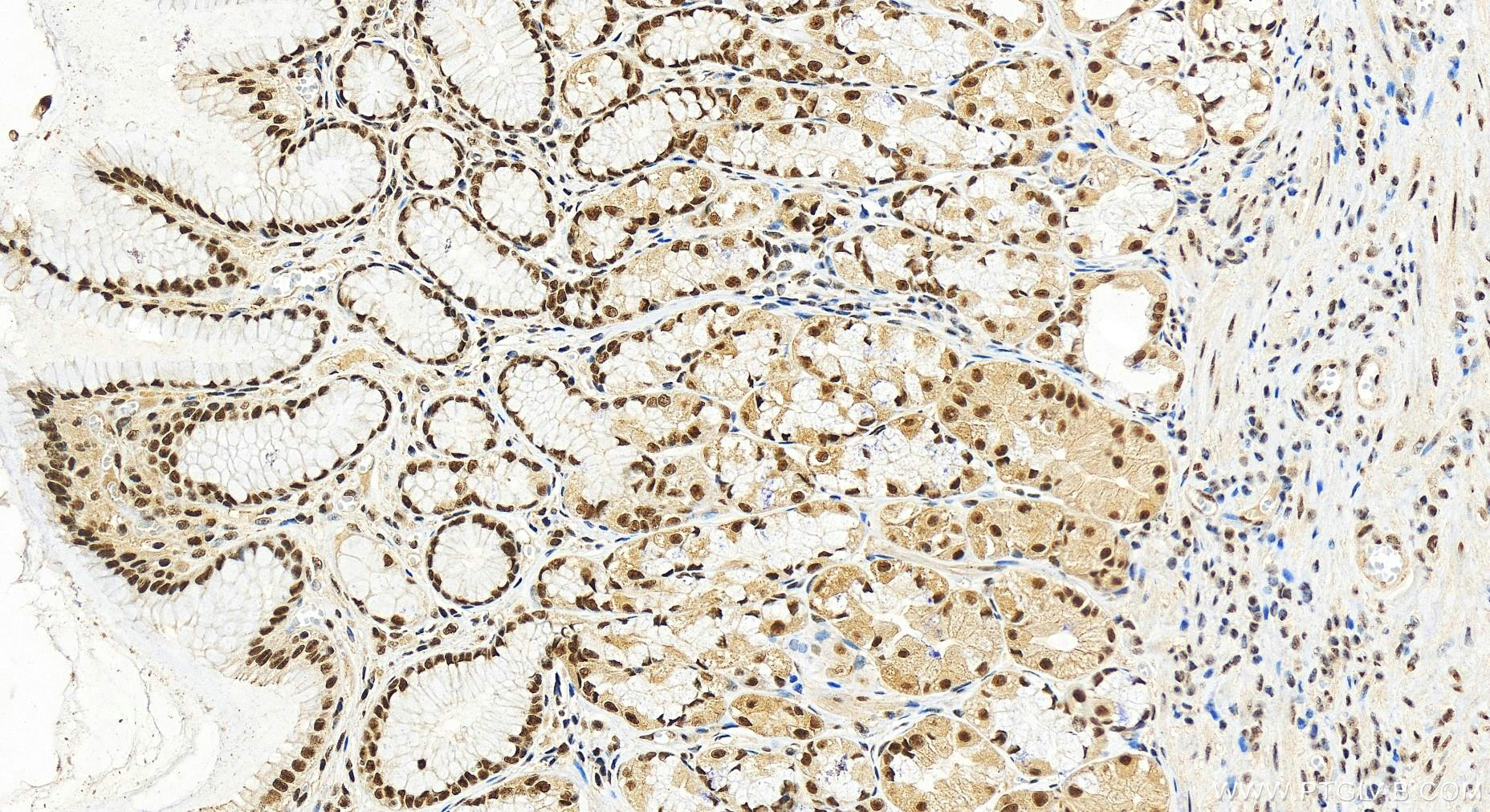 IHC staining of human stomach using 19930-1-AP