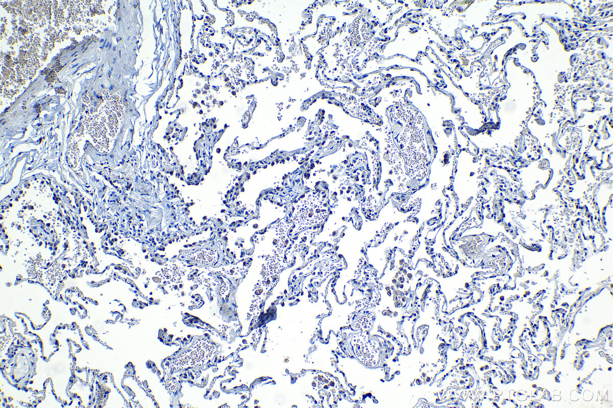 IHC staining of human lung using 19930-1-AP