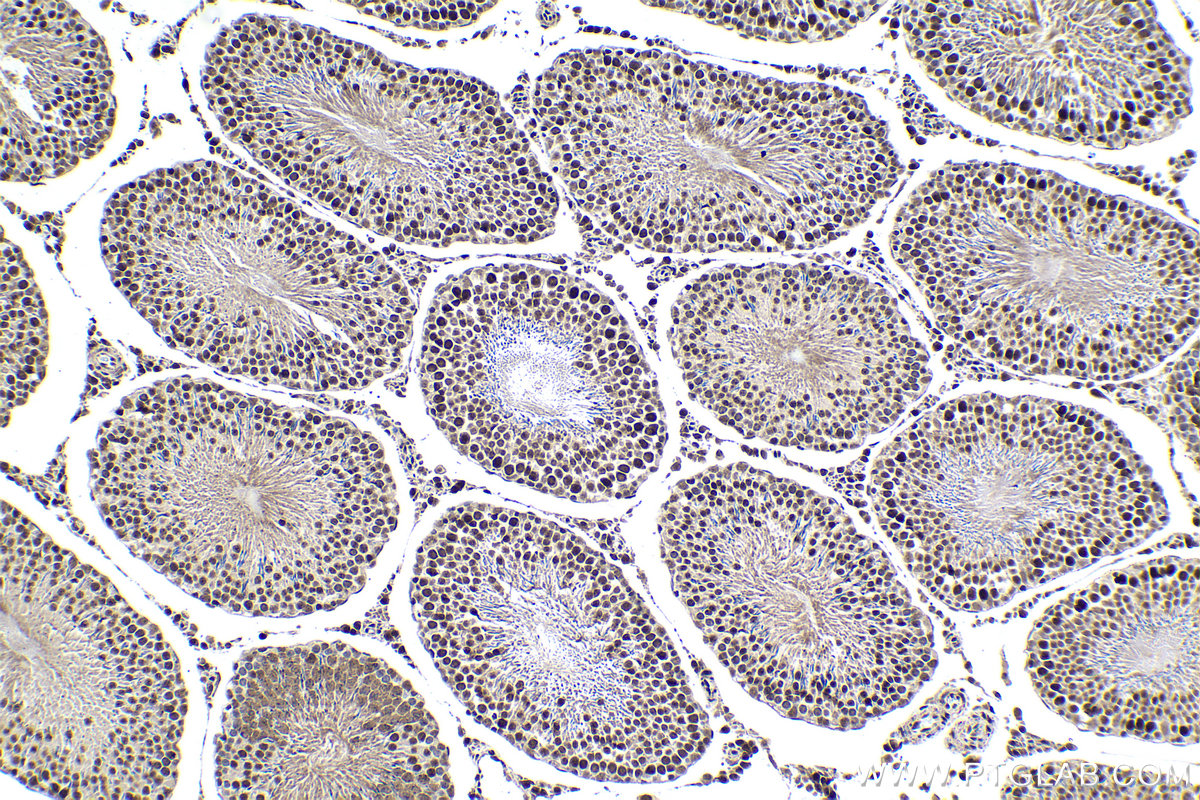 IHC staining of rat testis using 19930-1-AP