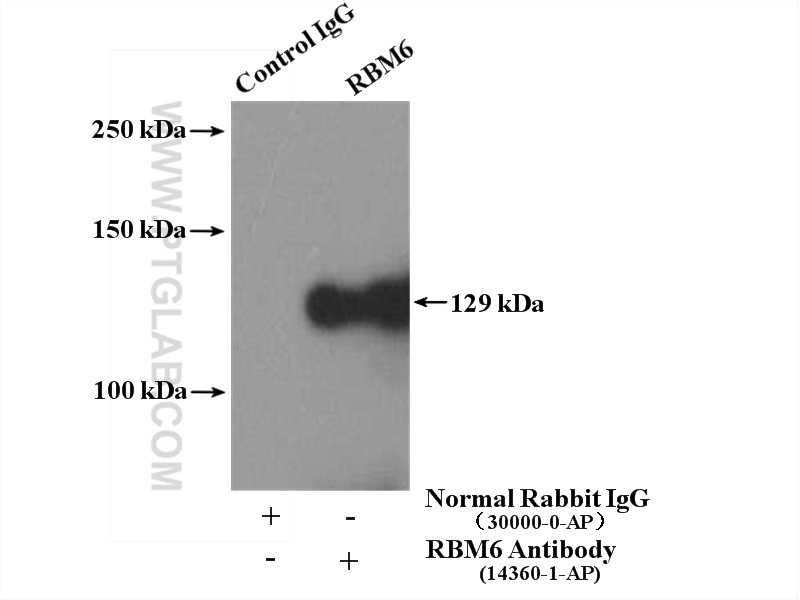 IP experiment of HeLa using 14360-1-AP