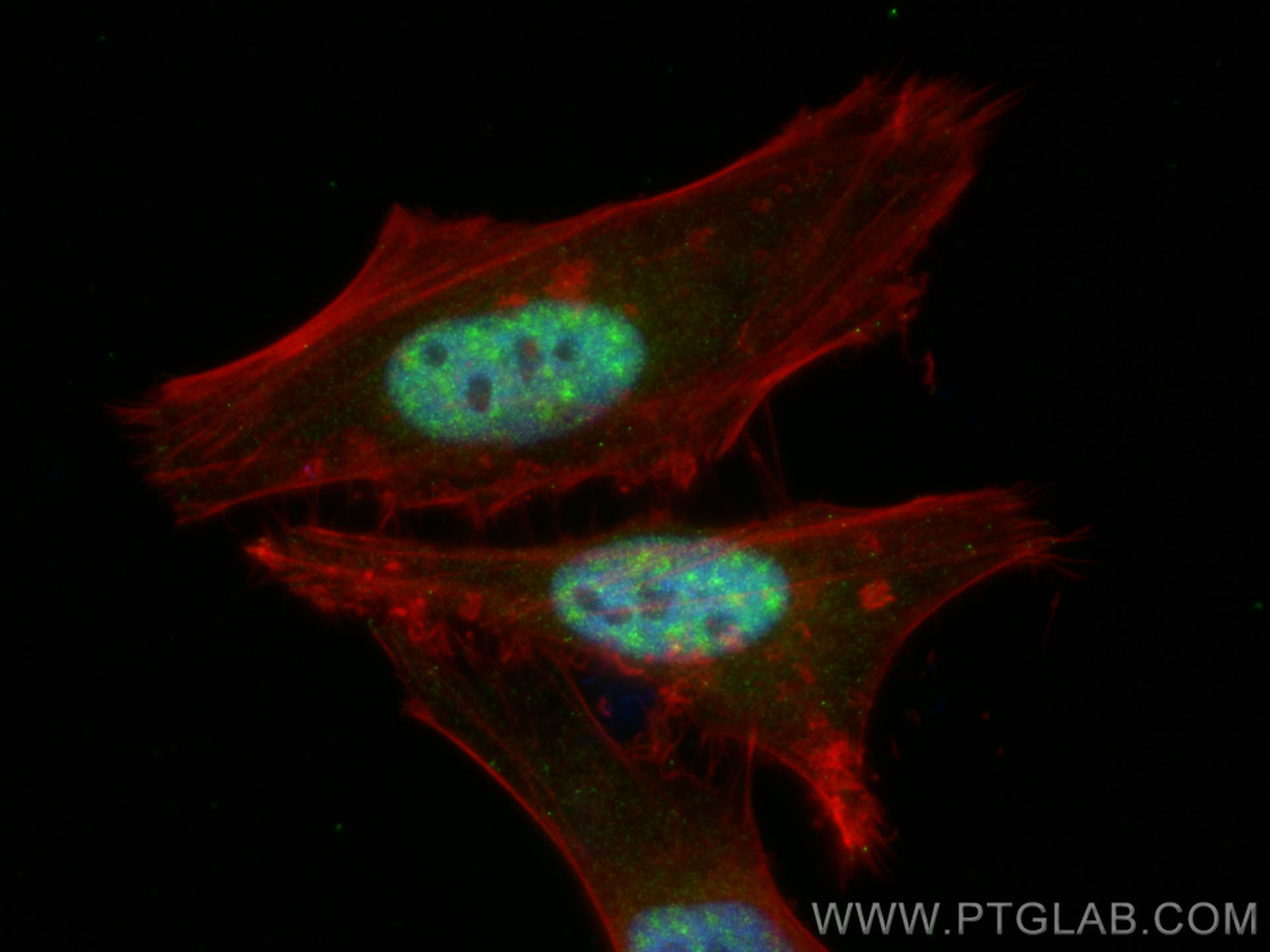 IF Staining of HeLa using 14958-1-AP